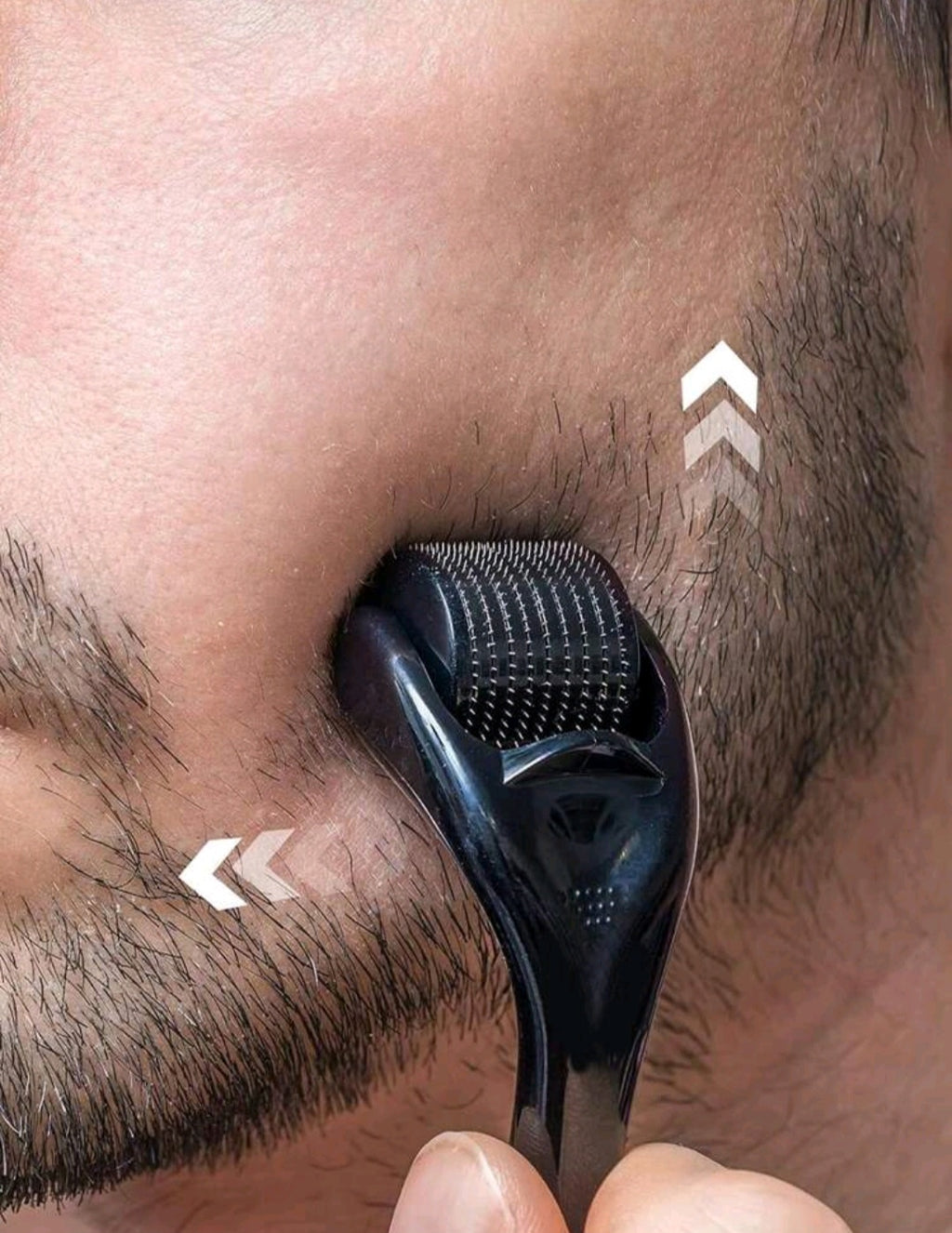 Microneedle Derma Roller